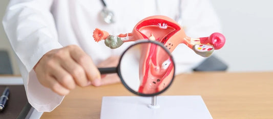 PCOS and Insulin Resistance: The Critical Connection Explained